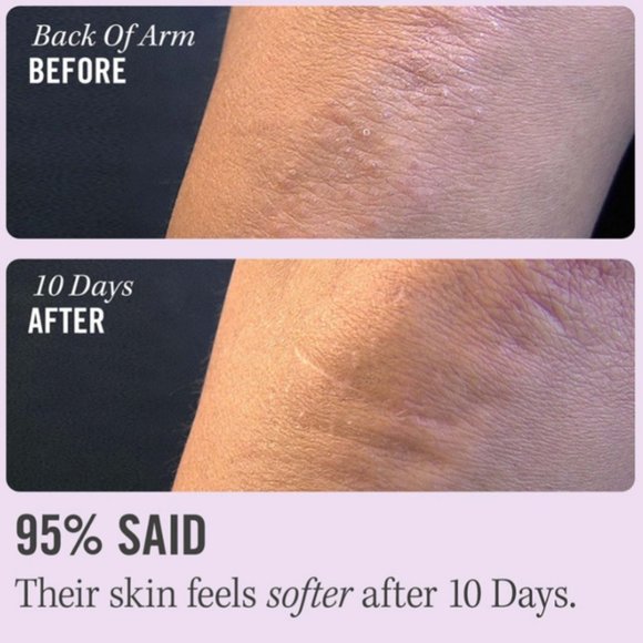 F.A.B. KP BUMP ERASER BODY SCRUB 10% AHA $35 - Picture 6 of 9